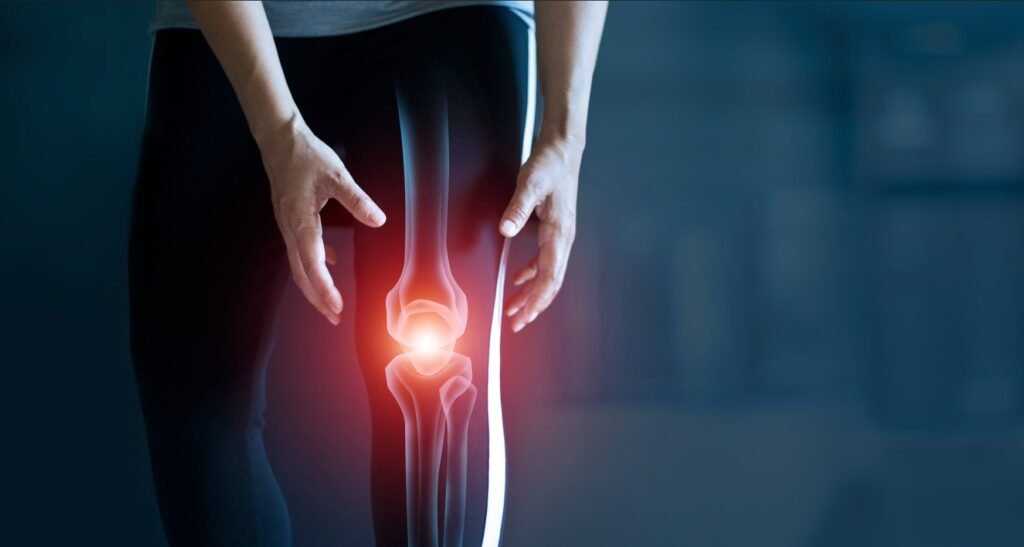 A person having knee pain.